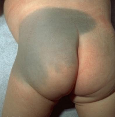 对号入座看看自己的痣,宝宝对号入座图片