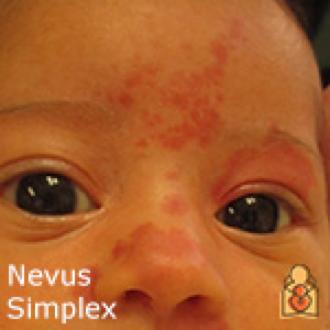 对号入座看看自己的痣,宝宝对号入座图片