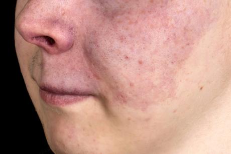 对号入座看看自己的痣,宝宝对号入座图片