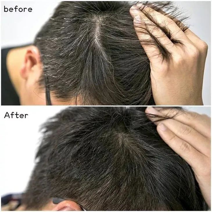 显白发色黄皮夏天,夏天适合染什么发色高级显白