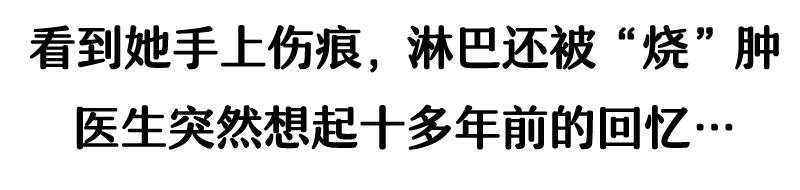 被流浪猫咬到没什么大事吧,不小心被猫咬了一口要打针么