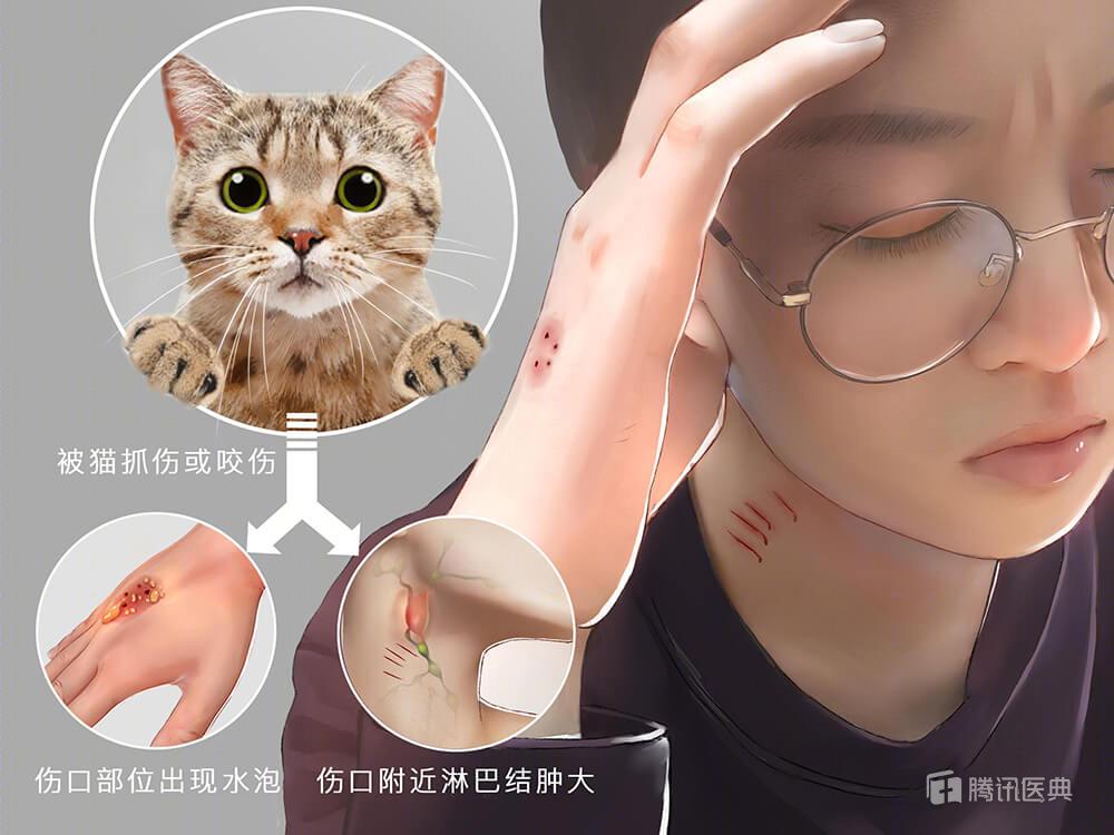 被流浪猫咬到没什么大事吧,不小心被猫咬了一口要打针么