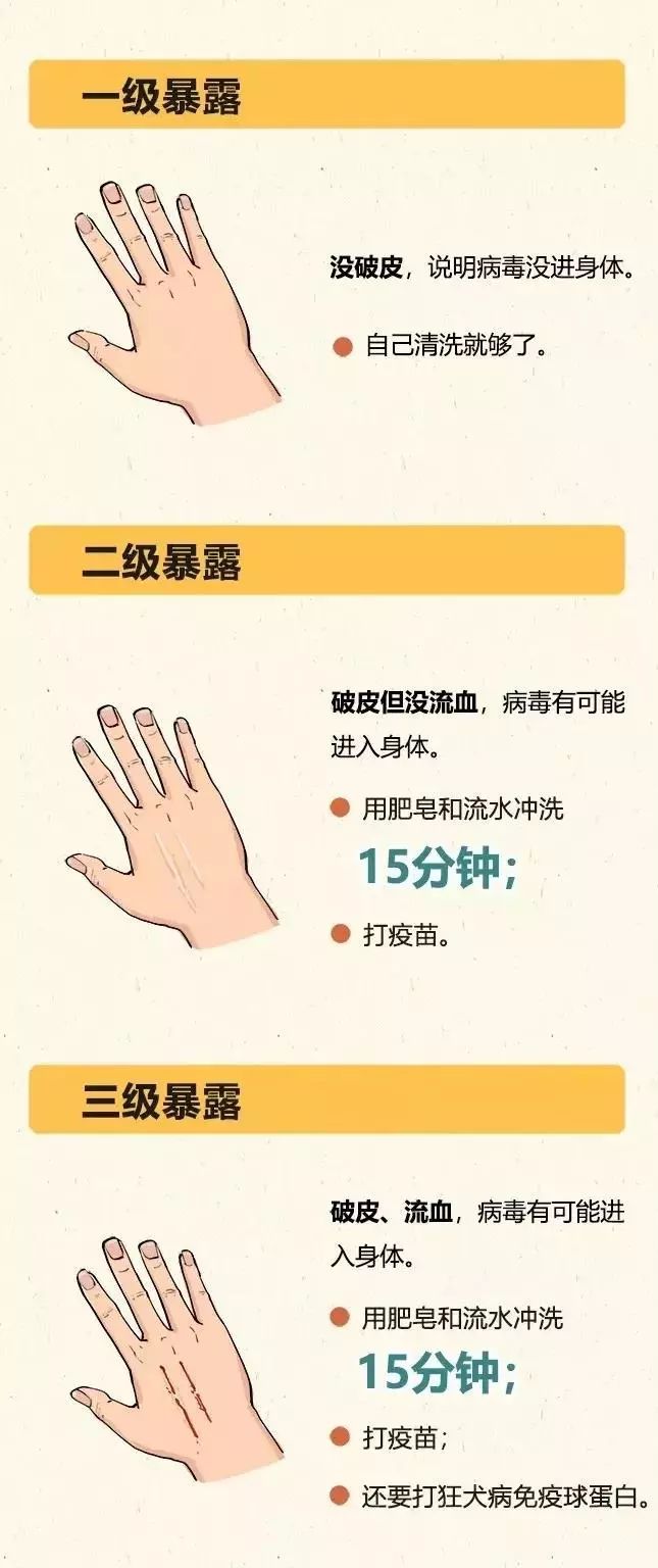 被流浪猫咬到没什么大事吧,不小心被猫咬了一口要打针么