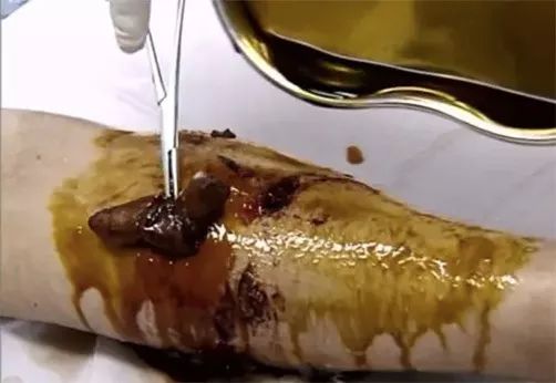 被流浪猫咬到没什么大事吧,不小心被猫咬了一口要打针么