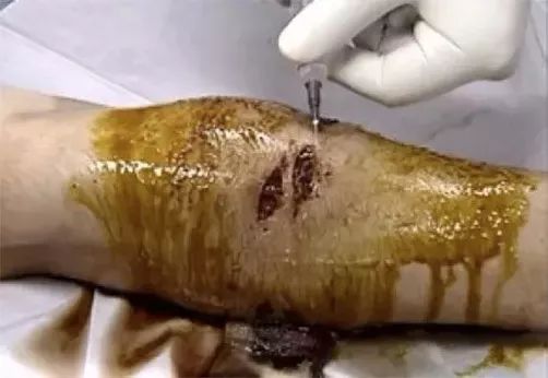 被流浪猫咬到没什么大事吧,不小心被猫咬了一口要打针么