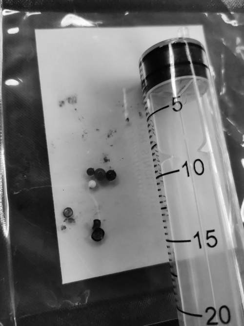 3-6岁儿童益智弹珠,4岁小孩吞下塑料弹珠能排出来吗