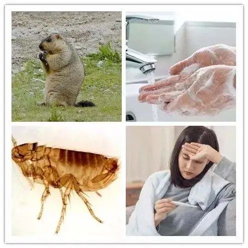 人间鼠疫病例,鼠疫的救治方法