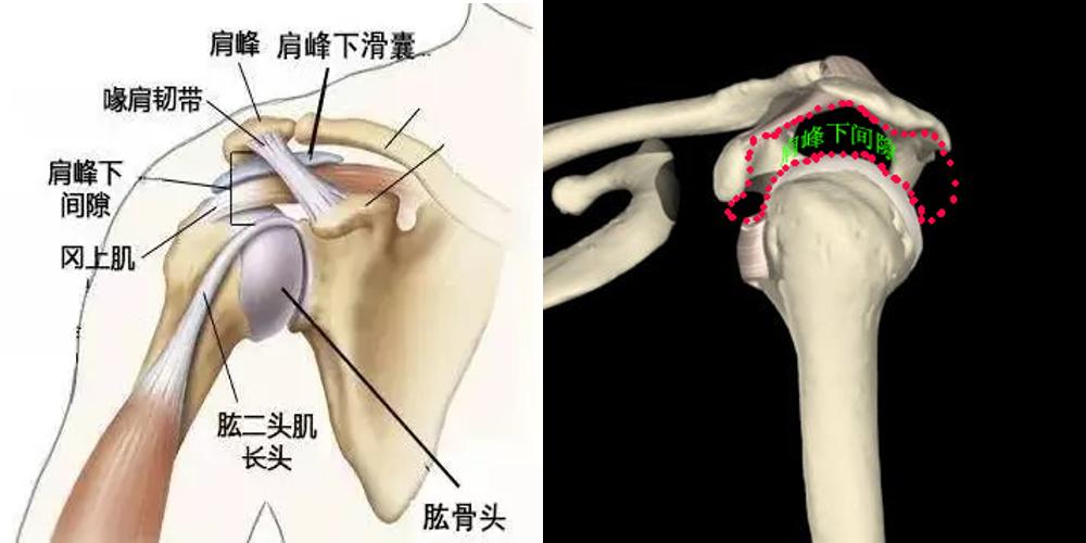 肩袖撕裂和肩峰撞击综合征一样么,肩峰下撞击综合征最佳治疗方法