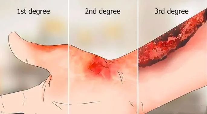 盘点那些差点让演员丧命的危险,在拍戏中遭遇不幸的演员