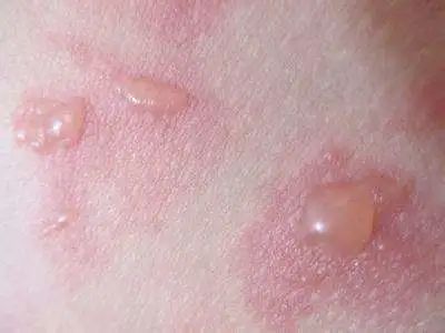 盘点那些差点让演员丧命的危险,在拍戏中遭遇不幸的演员