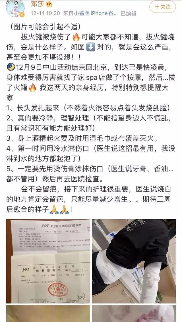 盘点那些差点让演员丧命的危险,在拍戏中遭遇不幸的演员