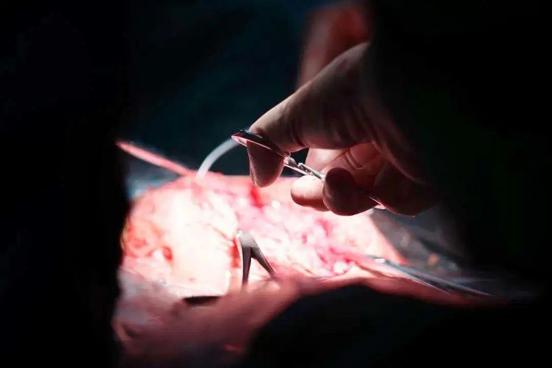 同房后“血崩”,90后姑娘差点丢了命!这个危险因素,你需要了解……