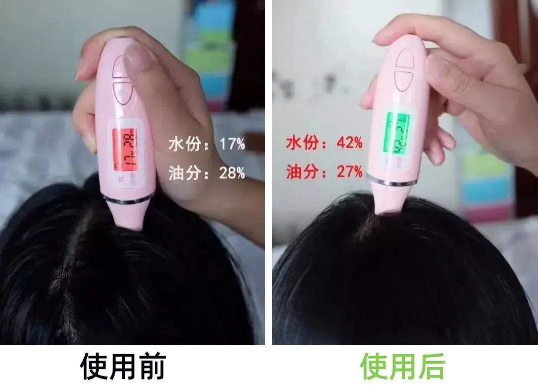 7天挑战无头屑,挑战5天不洗头依旧蓬松不油头