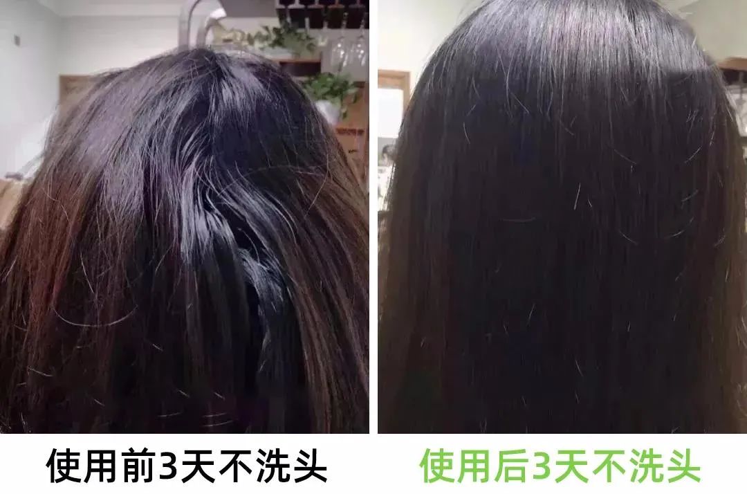 7天挑战无头屑,挑战5天不洗头依旧蓬松不油头