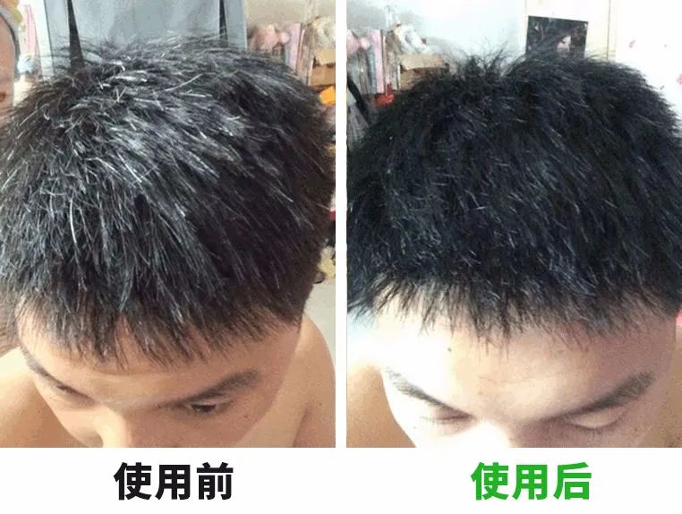 7天挑战无头屑,挑战5天不洗头依旧蓬松不油头