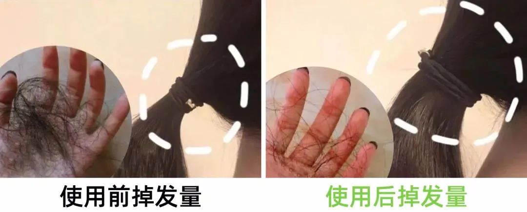 7天挑战无头屑,挑战5天不洗头依旧蓬松不油头