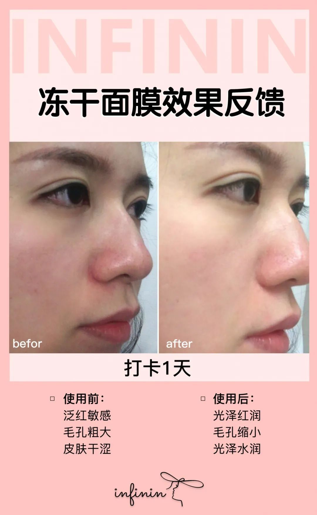 医护人员把这种鲜花当面膜，皮肤白嫩得让男人受不了，到底有多神奇？