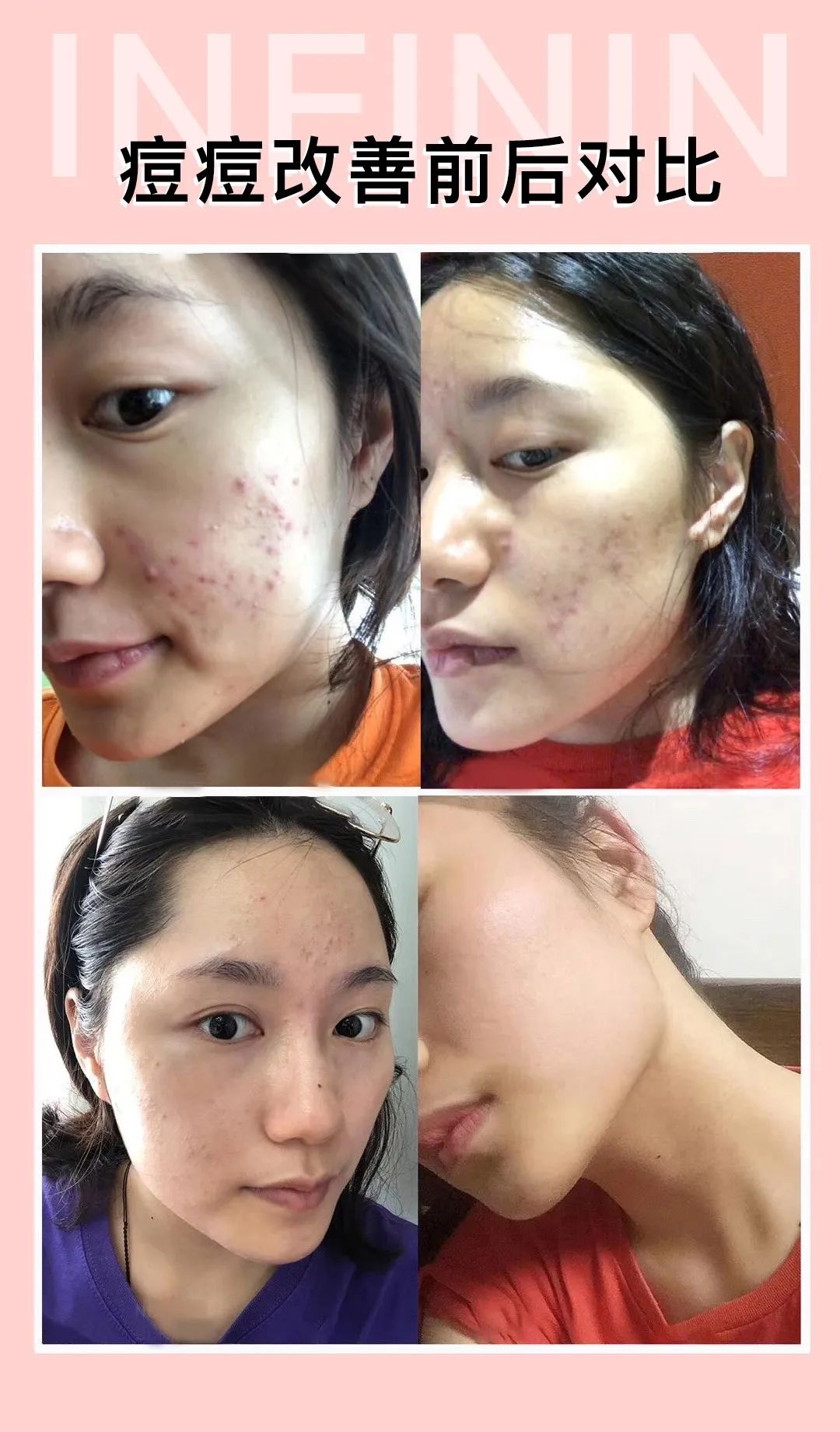 医护人员把这种鲜花当面膜，皮肤白嫩得让男人受不了，到底有多神奇？