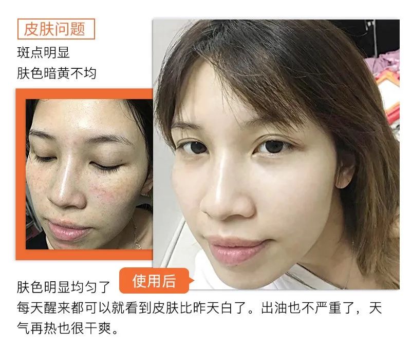 医护人员把这种鲜花当面膜，皮肤白嫩得让男人受不了，到底有多神奇？