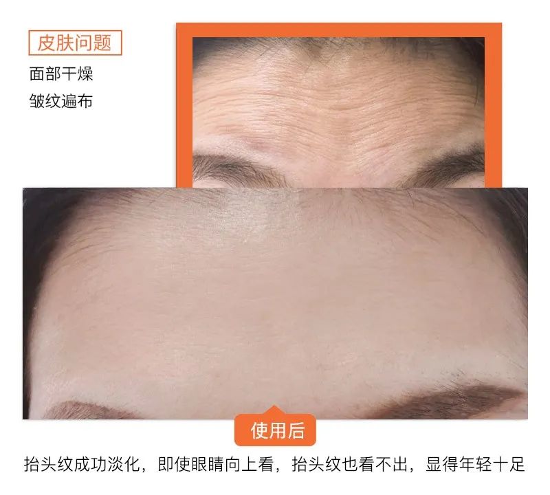 医护人员把这种鲜花当面膜，皮肤白嫩得让男人受不了，到底有多神奇？