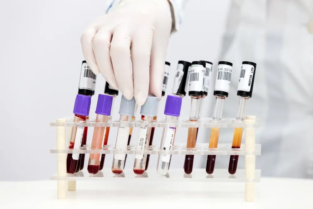 4岁小孩发热吃过药多久能退热,4岁小孩输液三天还在发热怎么办