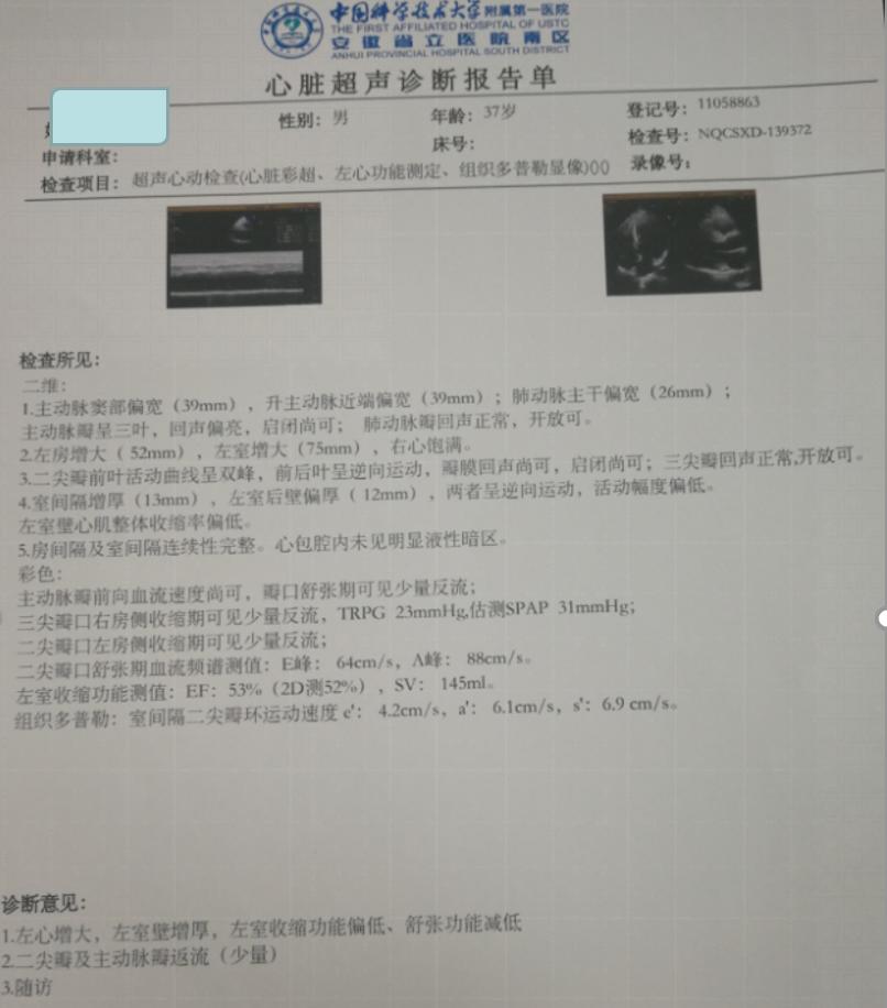 专家讲解arni药治疗心衰病例,抗心衰药物arni