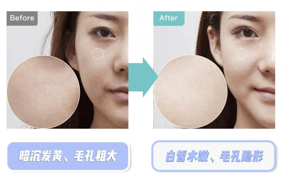 11块钱淡斑体验,1元享受美容养生护理无隐形消费