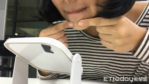 多囊卵巢综合征高雄现象,多囊卵巢综合征解密