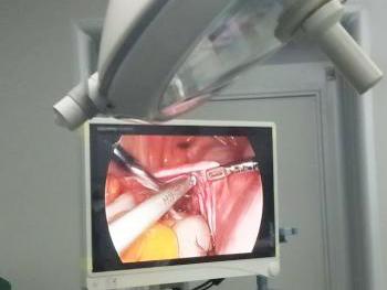 中年女士肚子大的跟怀孕一样,五岁小姑娘肚子突然变大了