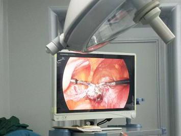 中年女士肚子大的跟怀孕一样,五岁小姑娘肚子突然变大了