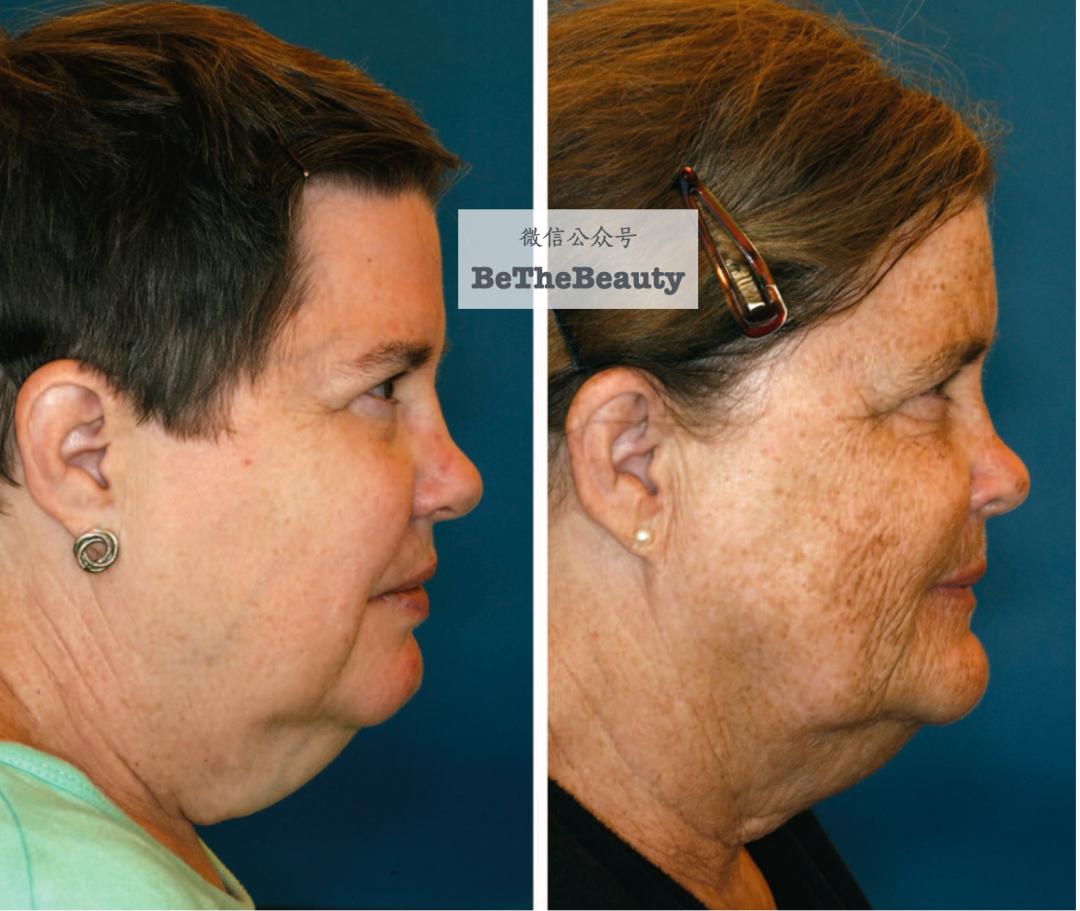 许晴vs钟丽缇：冻龄女神靠遗传还是靠努力？能学能用的超长待机法是？