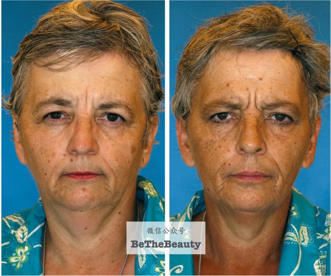 许晴vs钟丽缇：冻龄女神靠遗传还是靠努力？能学能用的超长待机法是？