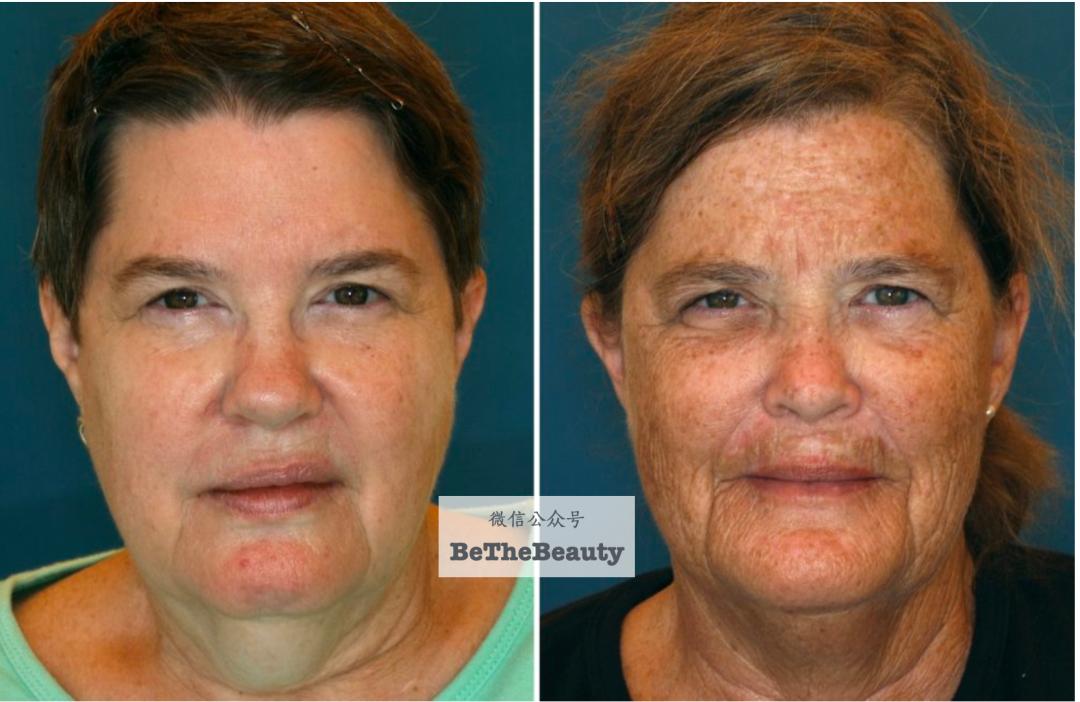 许晴vs钟丽缇：冻龄女神靠遗传还是靠努力？能学能用的超长待机法是？