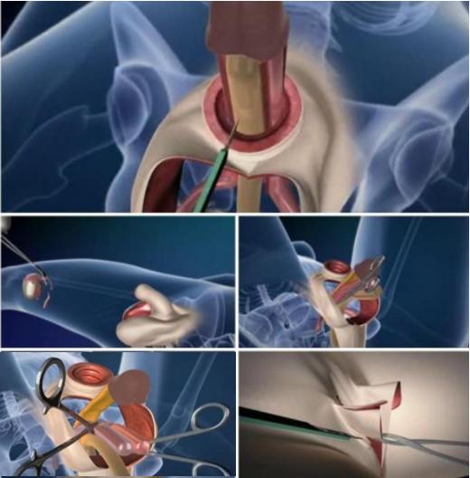 我跟一个做了变性手术的跨性别女生,聊了聊