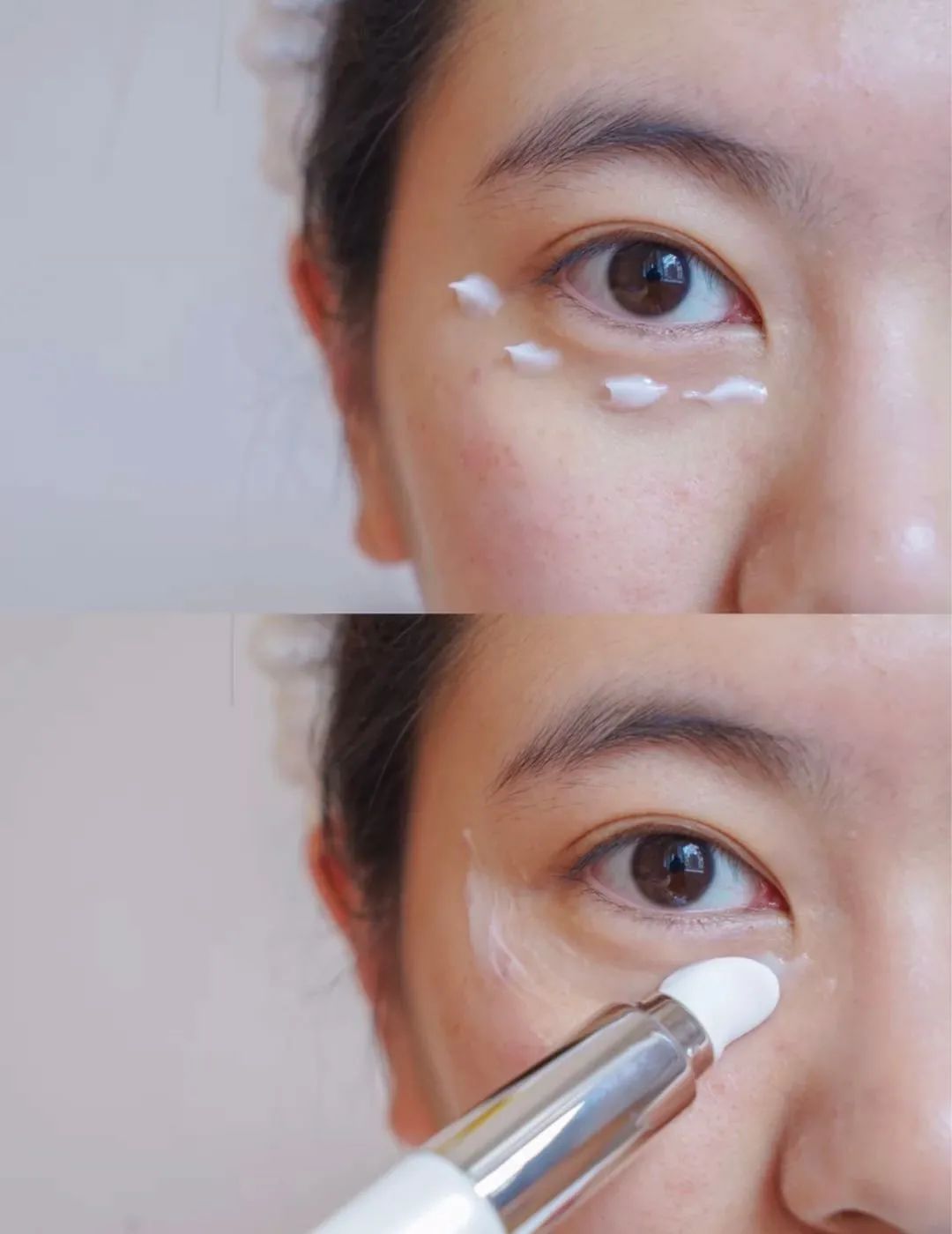 马应龙痔疮膏救了好多人,马应龙痔疮膏黑眼圈亲身体验