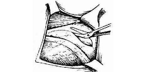 齐嫣婷医生讲科普|“动过刀”的子宫,能不能顺产?