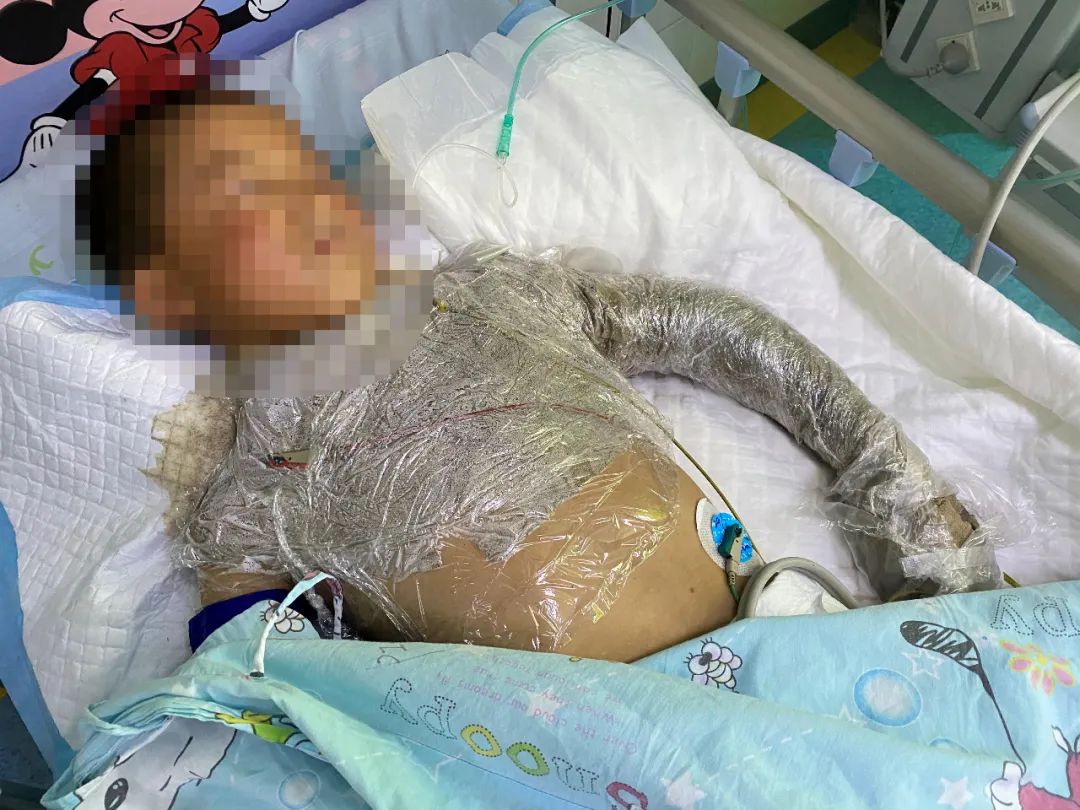 男孩摸了下“花蘑菇”，整个手变黑差点没命！夏天千万当心它