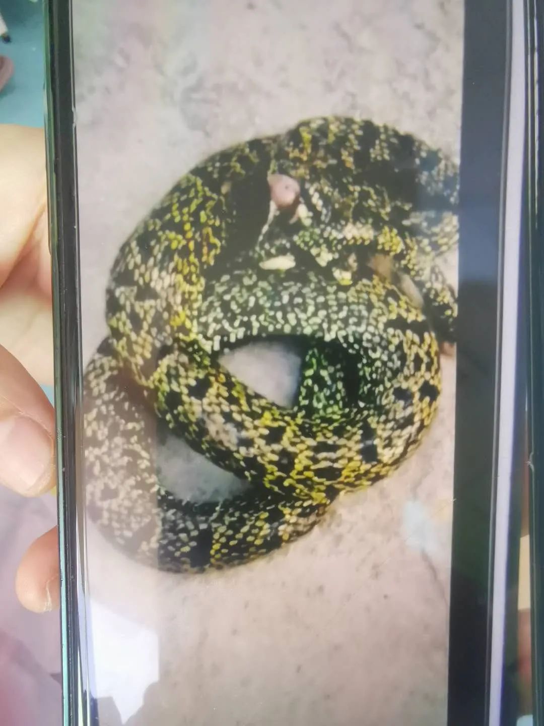 男孩摸了下“花蘑菇”，整个手变黑差点没命！夏天千万当心它