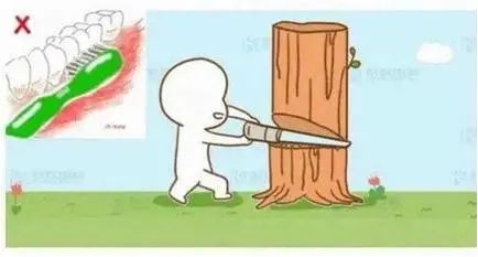 牙颈部楔状缺损,楔状缺损横沟修复