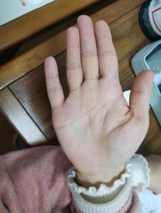 湿疹一直不退的原因是过敏吗,湿疹反复无能为力