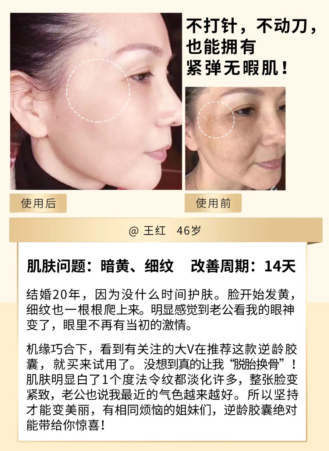 41岁“嗲精”撩遍娱乐圈男神,迷倒音乐教父!扭头嫁入亿万豪门!网友:她凭啥这么“浪”