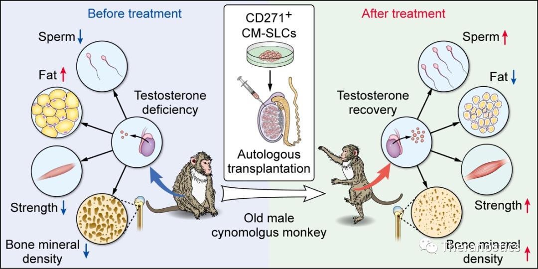 theranostics怎么样,自体干细胞移植治疗淀粉样疾病