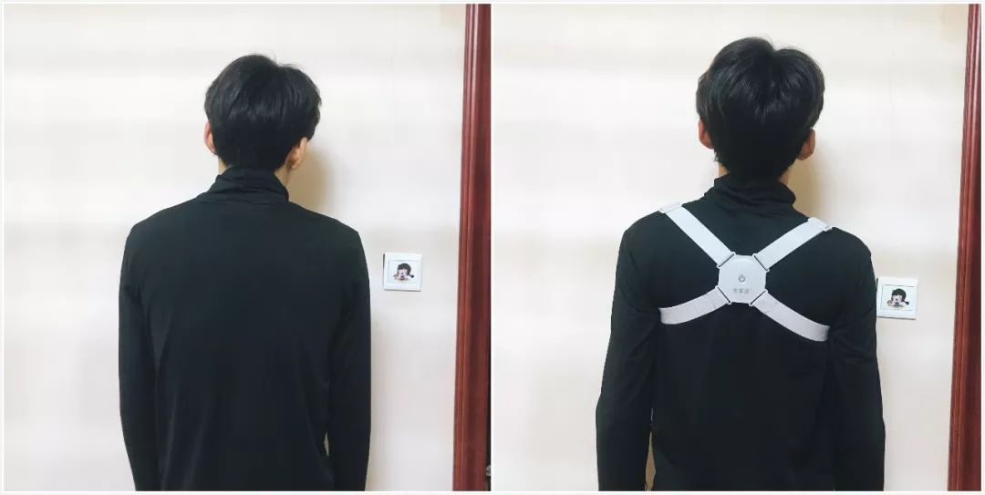 含胸驼背最损气质手把手教你纠正,含胸驼背如何改善提升气质