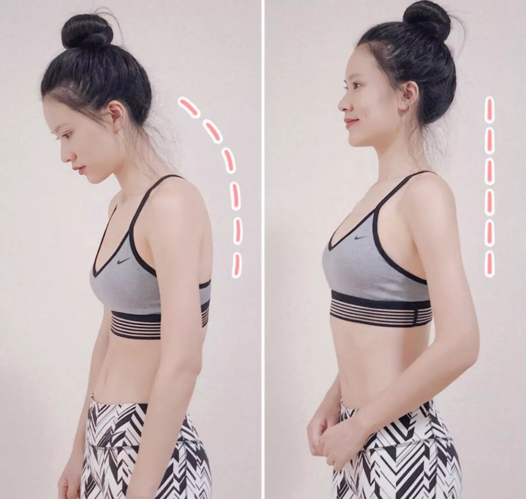 含胸驼背最损气质手把手教你纠正,含胸驼背如何改善提升气质