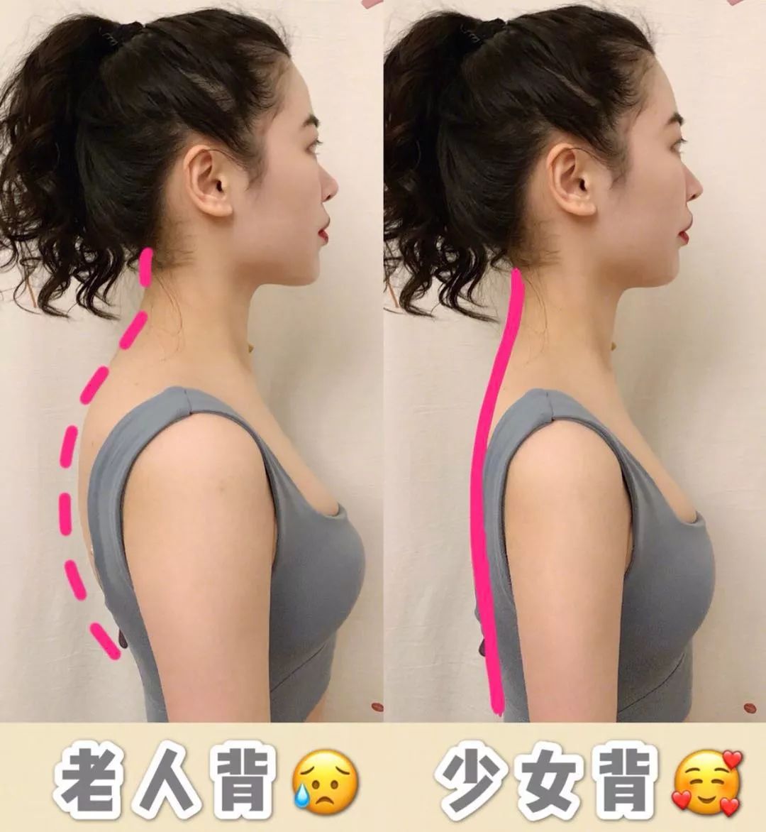 含胸驼背最损气质手把手教你纠正,含胸驼背如何改善提升气质