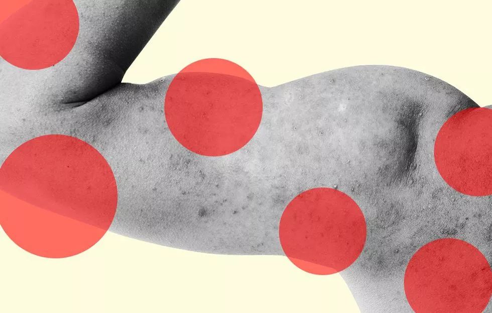 为什么抓痒感觉舒服,抓痒为什么很舒服