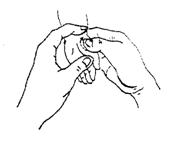 宝宝拉肚子找中医推拿,宝宝拉肚子不妨试试小儿推拿