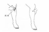 宝宝拉肚子找中医推拿,宝宝拉肚子不妨试试小儿推拿