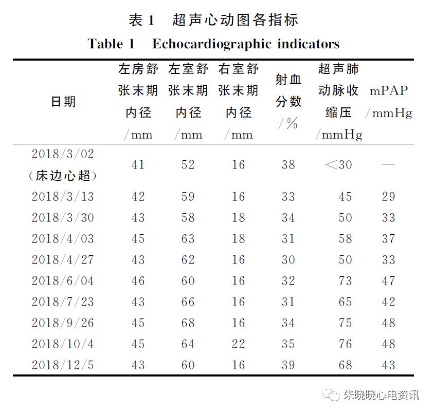 漏诊dewinter综合征,dewinter综合征相关心电图特点