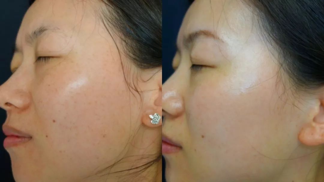 坚持美白全身,坚持做什么可以美白